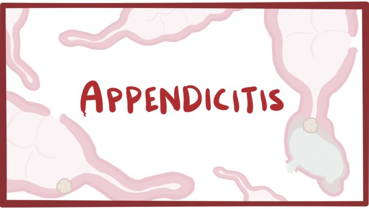 What Are The Common Signs Which Are Seen In Appendicitis?