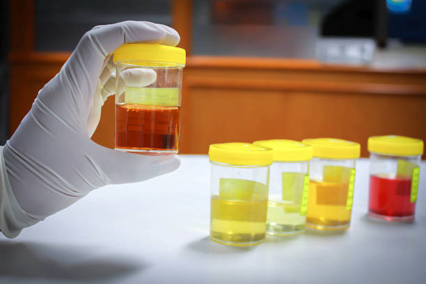 8 Things to Avoid Before Providing a Urine Sample